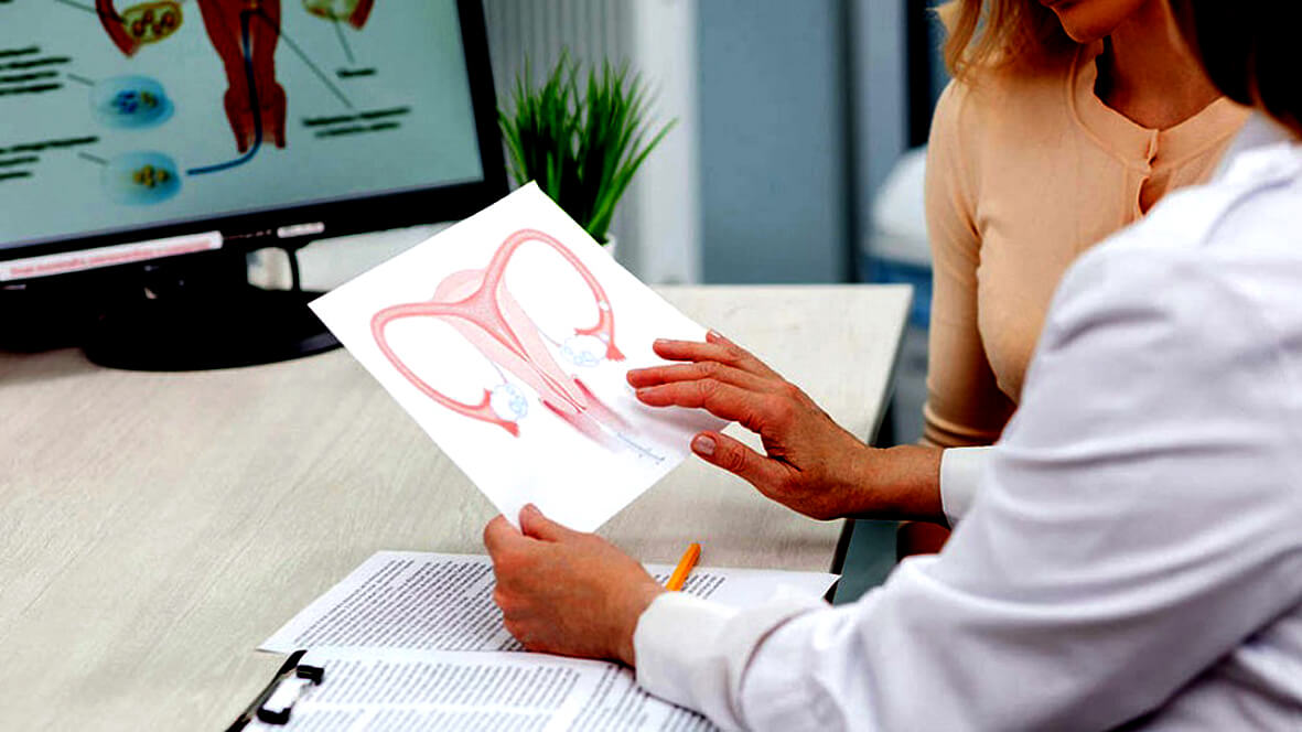 Imagen-cáncer-ovario