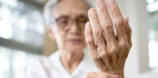 artritis-reumatoidea