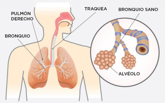asma-enfermedad-cronica
