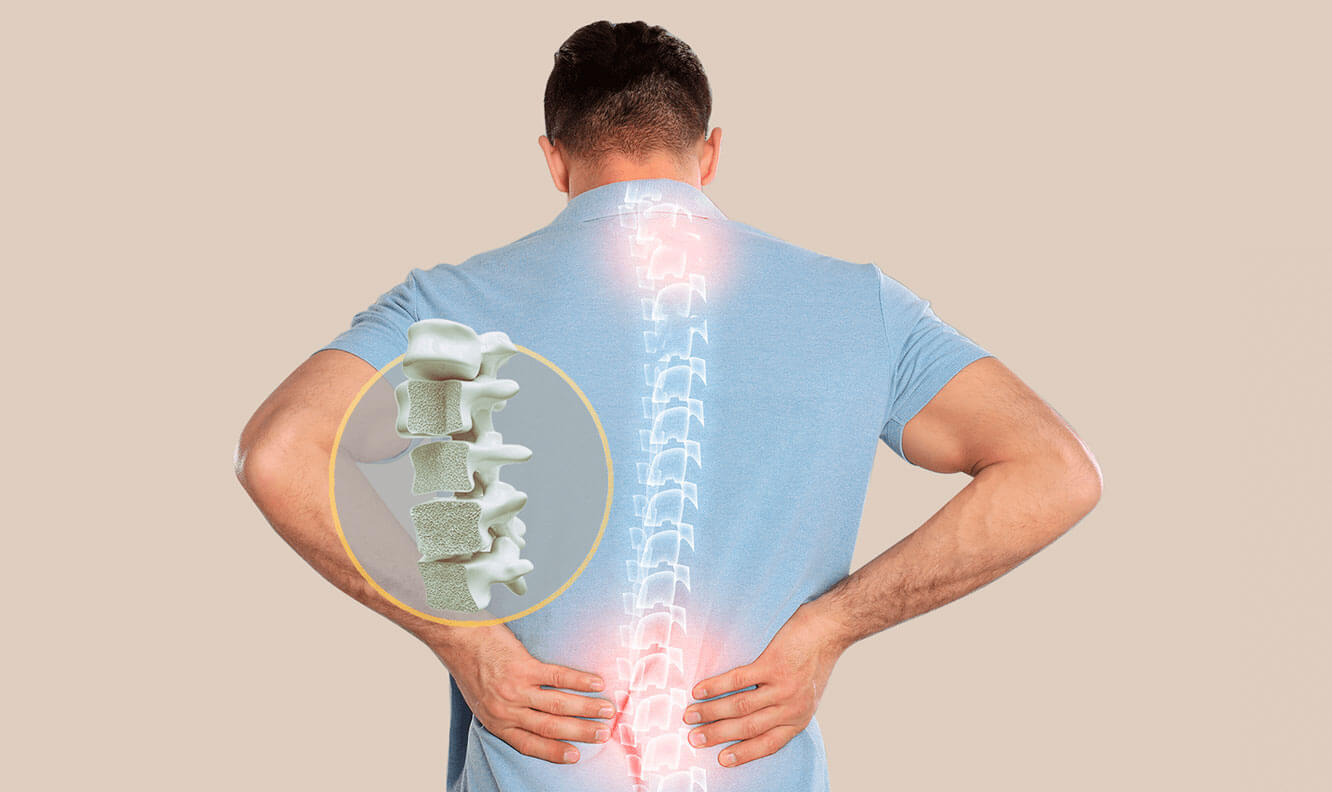 osteoporosis sanatorio urquiza